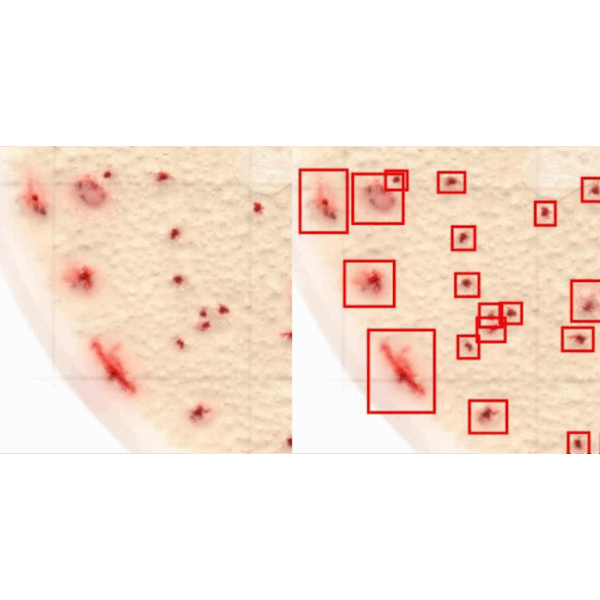 Labset Easy Plate AC-R_Conatgens Totais-Rapid_2 Labset Easy Plate AC-R_Conatgens Totais-Rapid_2